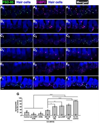Cyclic AMP signaling promotes regeneration of cochlear synapses after excitotoxic or noise trauma